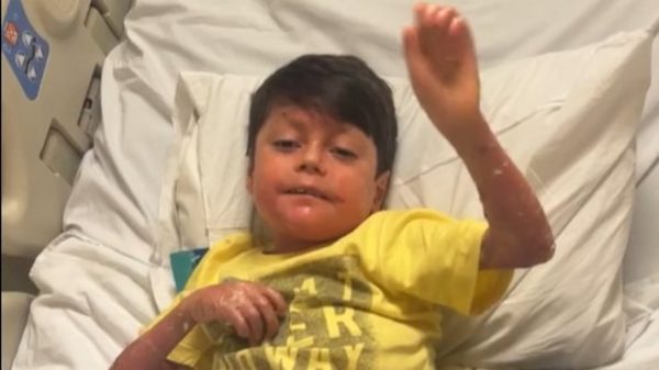 Epidermólise bolhosa: entenda a condição que causa “pele de borboleta”