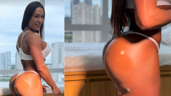 Entenda a harmonização nos glúteos feita por Gracyanne