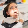 Mulher com a boca aberta em exame no dentista.