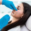 A durabilidade do preenchimento facial depende da anatomia, da pele e dos hábitos do paciente