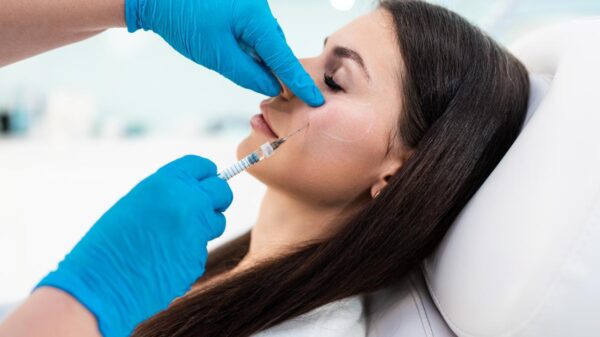 A durabilidade do preenchimento facial depende da anatomia, da pele e dos hábitos do paciente