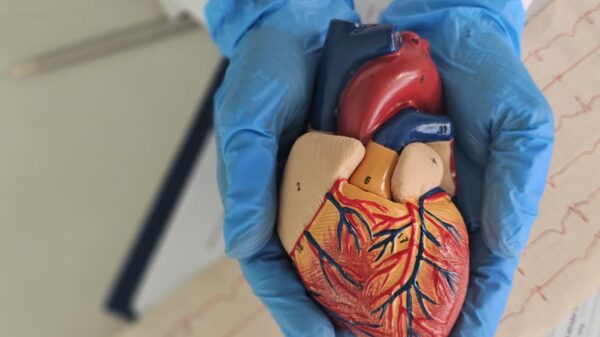 Aneurisma da aorta costuma não causar sintomas, mas pode evoluir para quadros graves sem acompanhamento médico