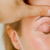 Blefaroplastia: entenda detalhes da cirurgia feita por Leonardo