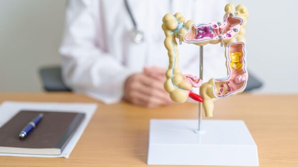 Imagem de um intestino de plástico, em cima de uma mesa do consultório médico