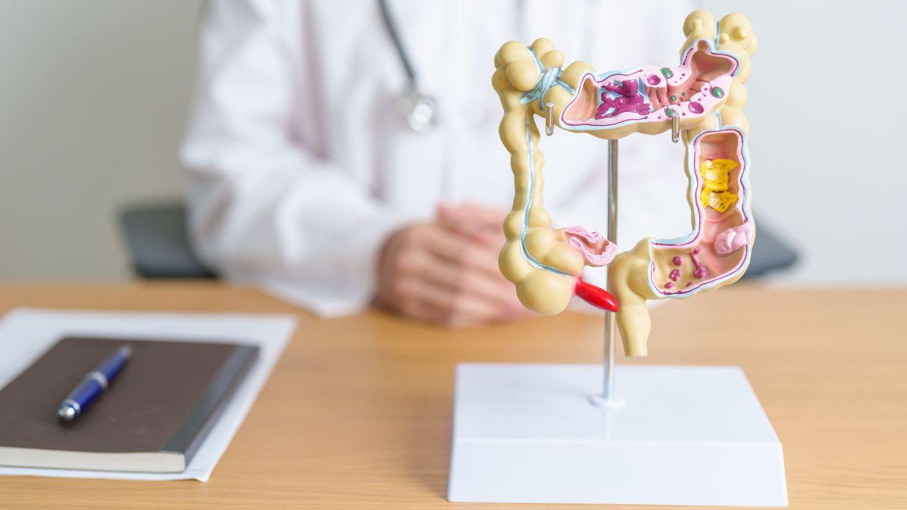 Imagem de um intestino de plástico, em cima de uma mesa do consultório médico