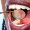 Mulher no dentista cuidando do sorriso