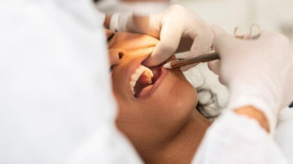 Você sabe o que fazer se quebrar um dente?