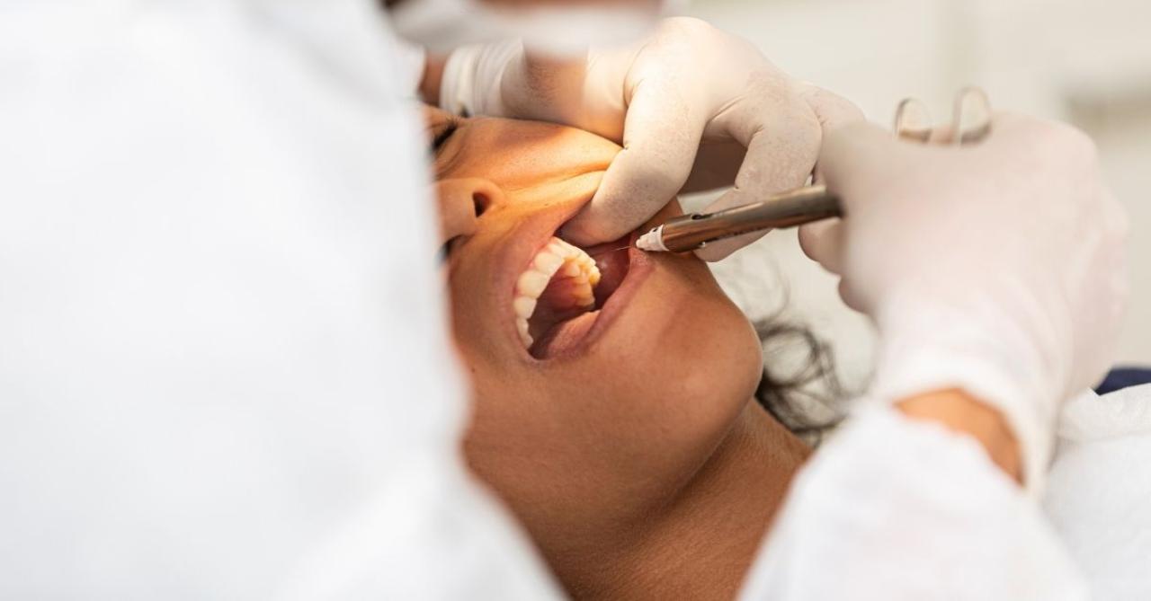 Você sabe o que fazer se quebrar um dente?
