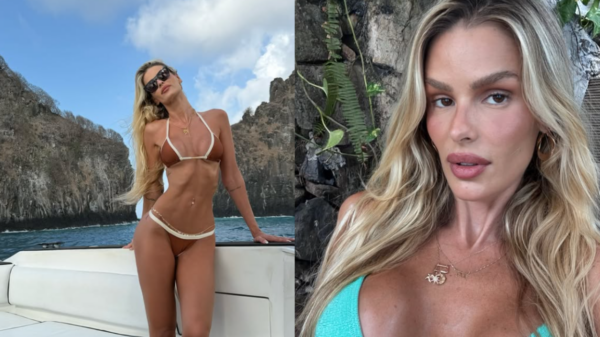 Yasmin Brunet compartilhou o antes e depois após tratar o lipedema e perder 15 kg