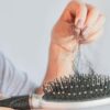 Alopecia: 5 sinais de alerta de que sua queda de cabelo é séria