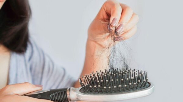 Alopecia: 5 sinais de alerta de que sua queda de cabelo é séria