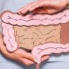 Alterações no intestino: o que pode indicar câncer colorretal