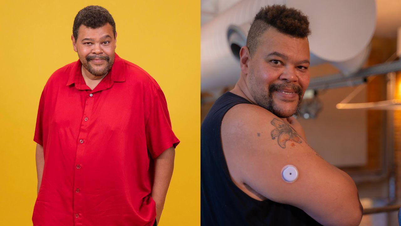 Montagem de duas fotos do Babu, a segunda, com o adesivo para diabetes no braço