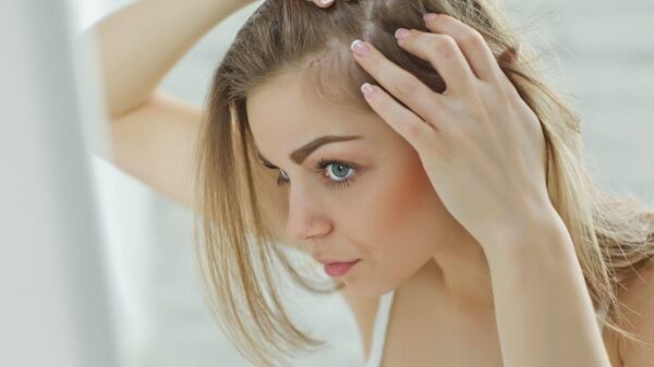 Seu cabelo caiu após o parto? Saiba por que isso acontece