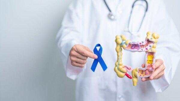 Veja os sintomas do câncer colorretal e o que preocupa os especialistas