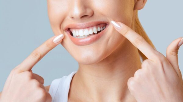 Mulher mostrando os dentes bem brancos.