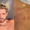 João Guilherme passa por remoção de tatuagens com tratamento a laser