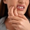 Foto mostra mulher rangendo a boca com dor de dente.