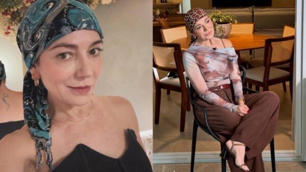 Montagem de duas fotos de Karina Lucco com lenço na cabeça