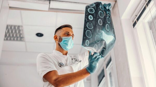 Aneurisma cerebral: sintomas, fatores de risco e quando ir ao hospital