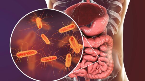 Bactérias que emagrecem: como o intestino pode influenciar na perda de peso