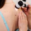 Câncer de pele: 11 mitos que atrasam o diagnóstico, alerta dermatologista