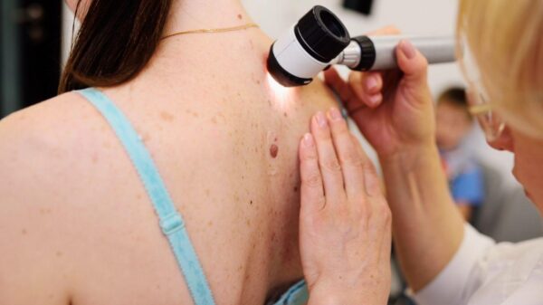 Câncer de pele: 11 mitos que atrasam o diagnóstico, alerta dermatologista