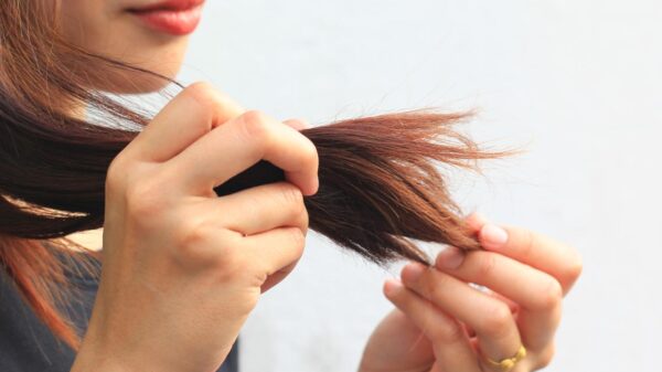 Creatina não tem relação comprovada com queda de cabelo, segundo evidências atuais