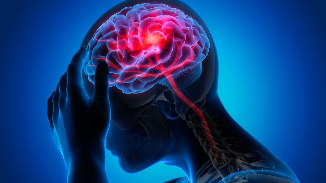 Enxaqueca aumenta o risco de AVC? Saiba os sinais e como se proteger