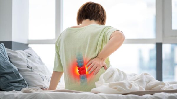 Hérnia de disco pode causar dores intensas, mas nem sempre exige cirurgia