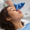 rinoplastia