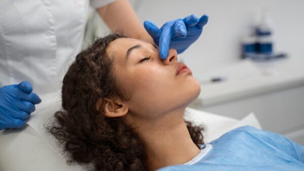 rinoplastia