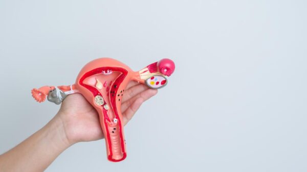 Saiba o que pode agravar os sintomas da endometriose e comprometer a qualidade de vida