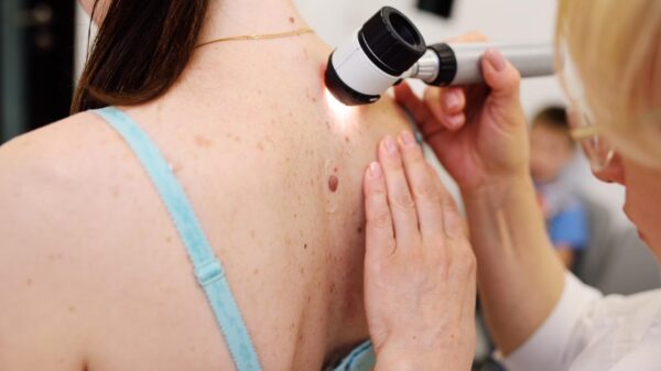 10 razões para visitar o dermatologista com mais frequência