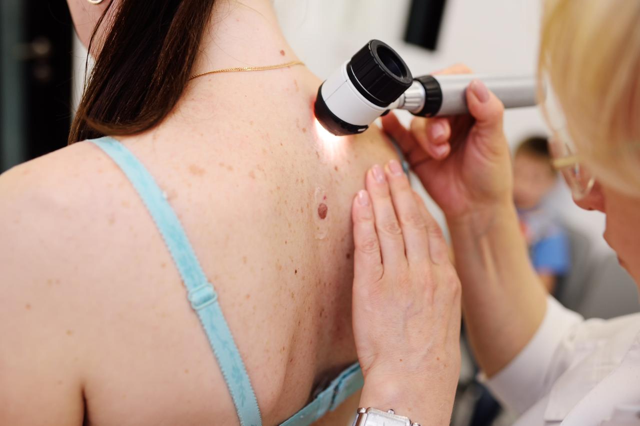 10 razões para visitar o dermatologista com mais frequência