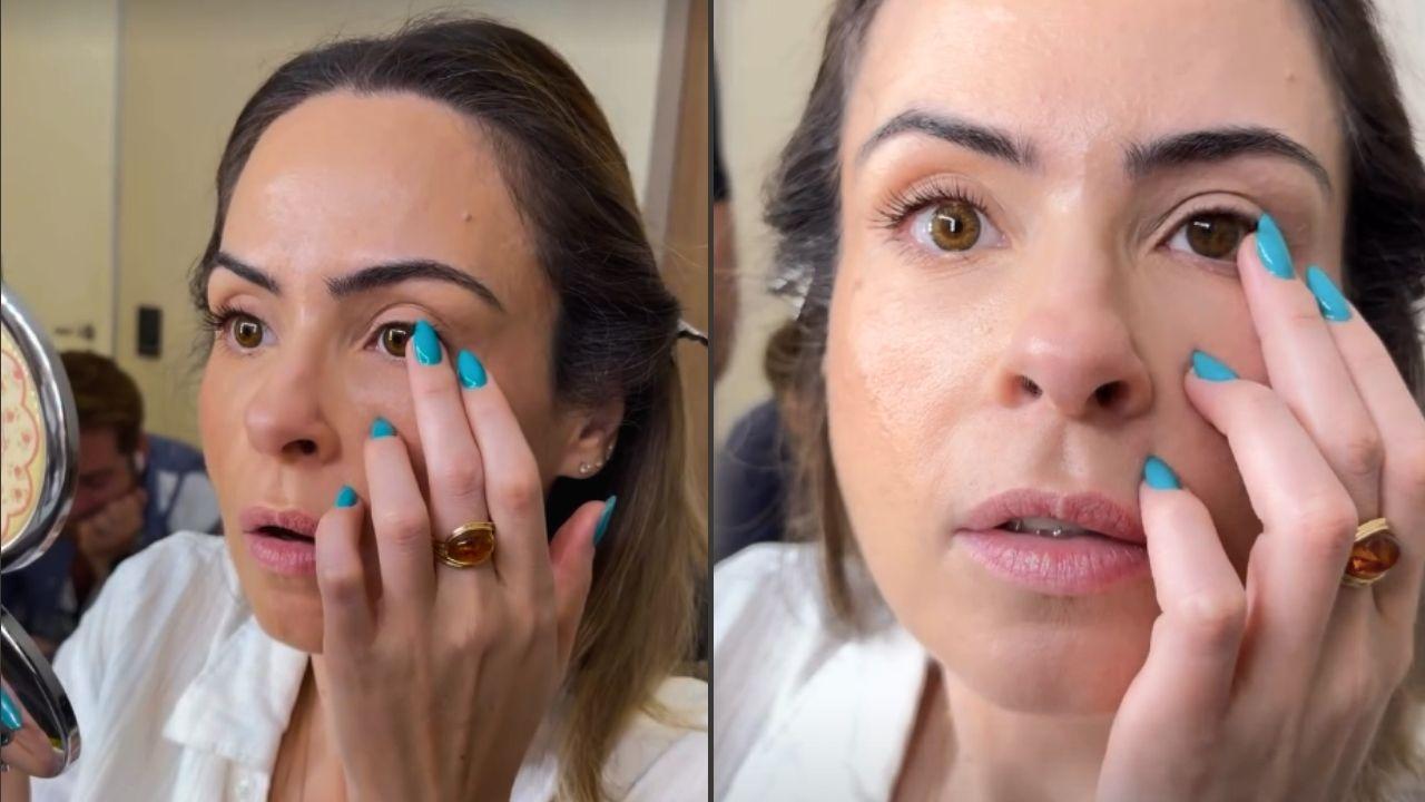 É seguro usar lentes coloridas com grau? Entenda caso de Ana Paula Renault
