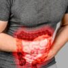 Intestino inflamado