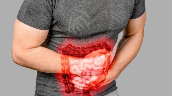Intestino inflamado