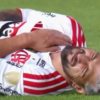 Lesão de Arrascaeta: entenda a fratura na clavícula e os riscos para o atleta