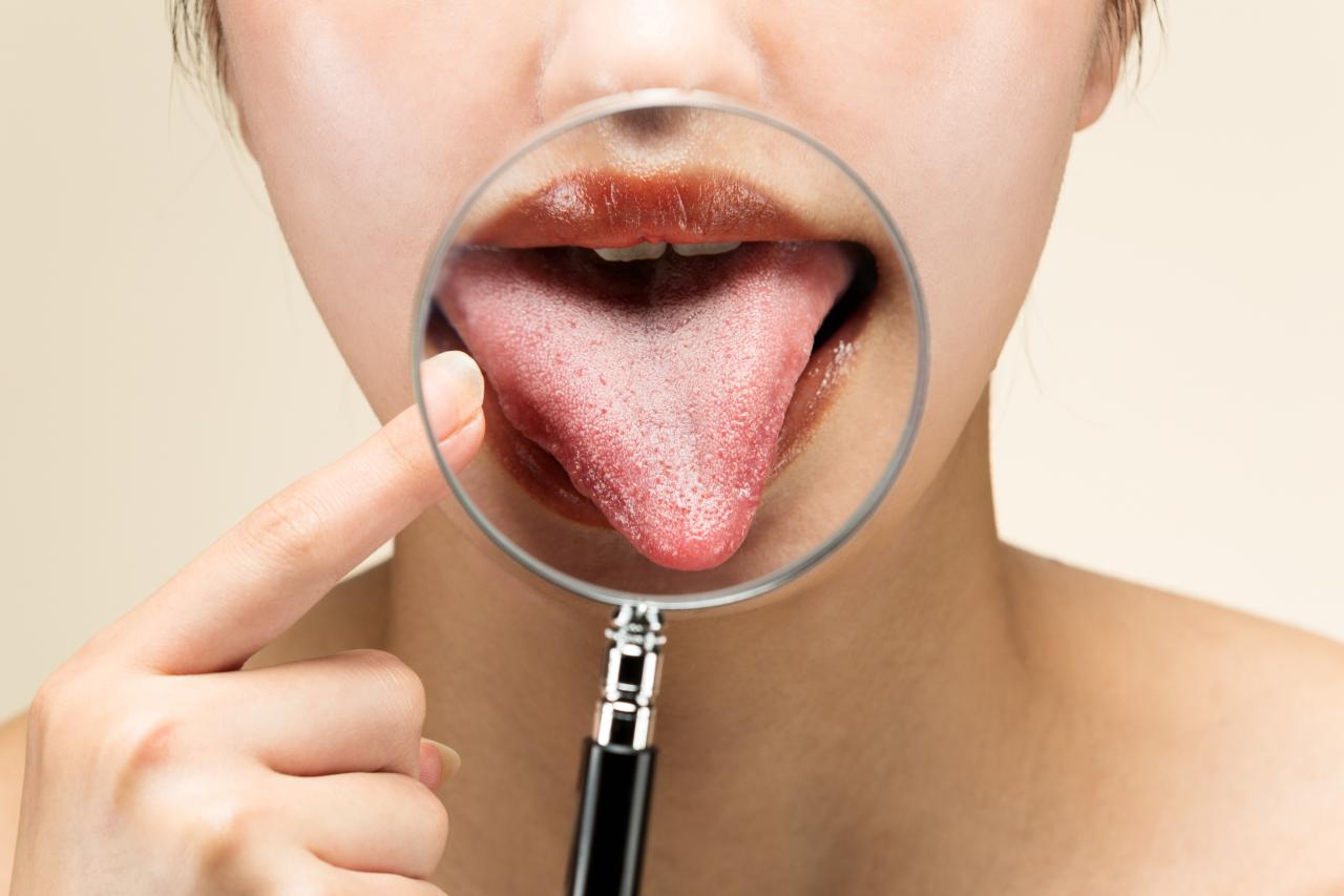 Língua branca ao acordar: é normal ou precisa de atenção?
