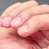 Mudanças nas unhas podem indicar carência de vitaminas e minerais