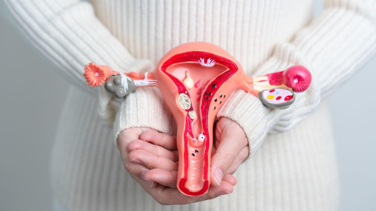Imagem de uma mulher segurando uma peça de plástico de um útero