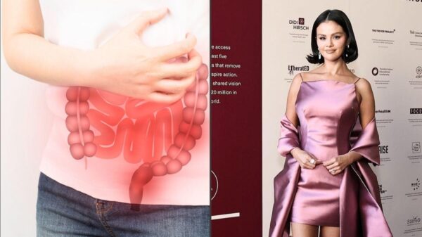 O que é SIBO? Entenda a condição intestinal que afeta Selena Gomez