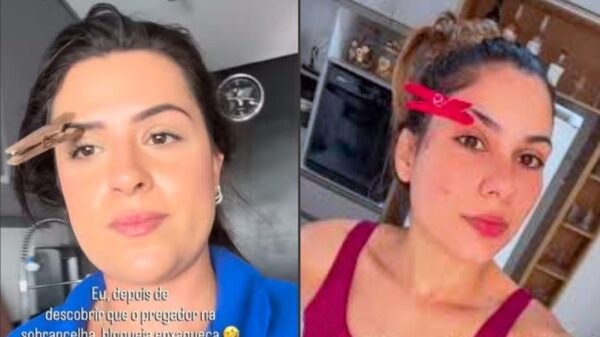 Truque do pregador na sobrancelha alivia enxaqueca? Médica faz alerta
