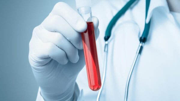 Foto mostra um médico segurando um frasco de sangue.