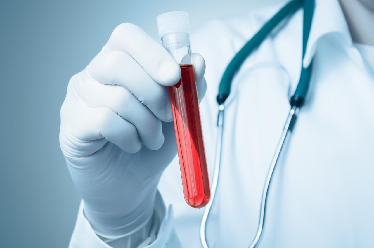 Foto mostra um médico segurando um frasco de sangue.