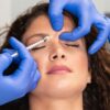 Uso de botox antes dos 30 cresce, mas exige avaliação e cuidado para evitar excessos