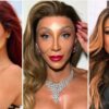Veia na testa, mãos perfeitas: os procedimentos mais inusitados das famosas