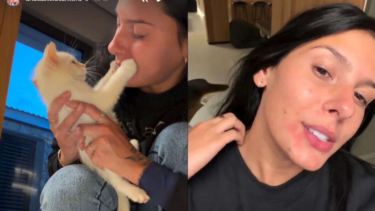 Montagem de duas fotos da Ana Castela com alergia.