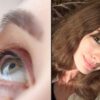 Anne Hathaway expõe problema de visão silencioso e alerta especialistas